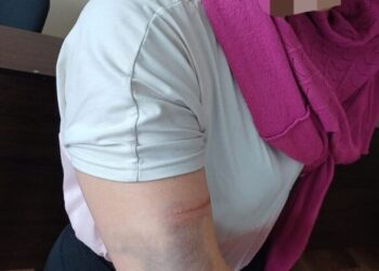 На Черкащині нетверезий чоловік побив колишню дружину (ФОТО)