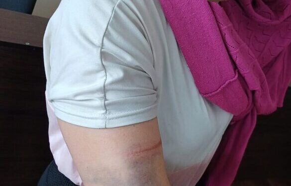 На Черкащині нетверезий чоловік побив колишню дружину (ФОТО)