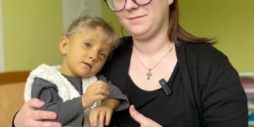 У Львові вперше в Україні лікуватимуть дітей із рідкісним захворюванням — синдромом Алажиля