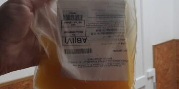 Рівненська журналістка просить здати кров для її брата