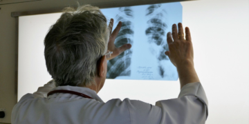 Епідемія туберкульозу повернулася на Полтавщину