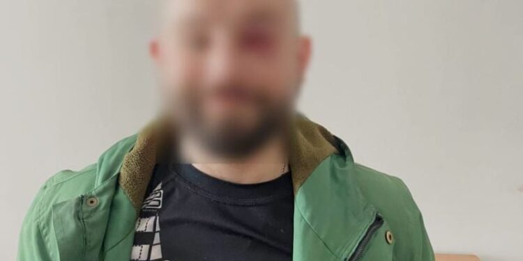 На Шепетівщині судять чоловіка за зберігання особливо небезпечних наркотиків —Хмельнитчина