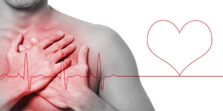 Де в Запоріжжі можна отримати безоплатну меддопомогу при інфаркті | Новини Запоріжжя