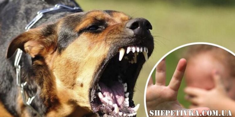 Ледве не відкусили дитині палець: у Шепетівці почастішали напади безпритульних собак —Хмельнитчина