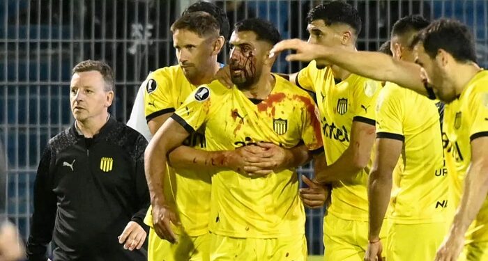 В Аргентине футболист получил камнем в голову от фаната