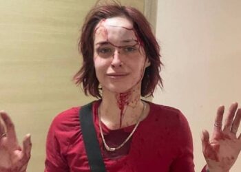 Одеський облТЦК розпочав перевірку через побиття дівчини милицями в центрі міста