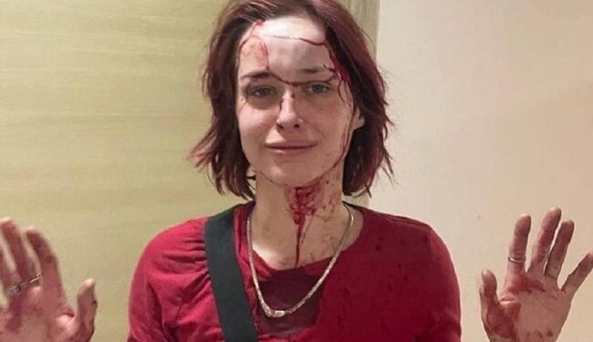 Побиття дівчини працівником ТЦК в Одесі: в ОК “Південь” назвали відео “роботою на ворога”