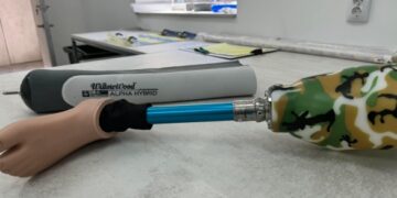 У Золотоноші відкрили протезувальний центр з реабілітацією