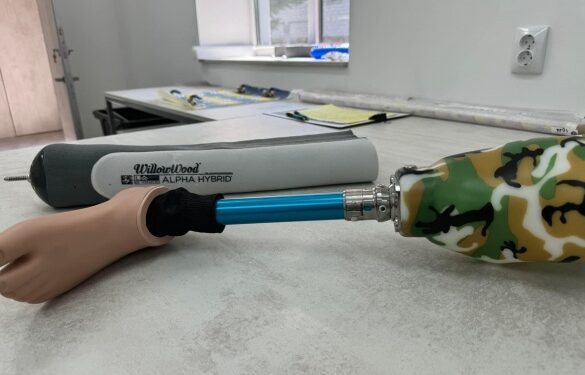 У Золотоноші відкрили протезувальний центр з реабілітацією