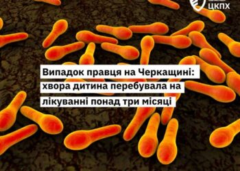 Хвора на правець дитина перебувала на лікуванні понад три місяці — Новости Черкасс