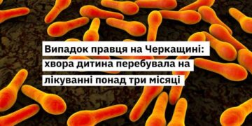 Хвора на правець дитина перебувала на лікуванні понад три місяці — Новости Черкасс