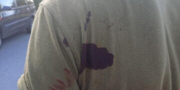 На Хмельниччині чоловік напав на працівника ТЦК із ножем —Хмельнитчина