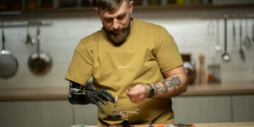 Український виробник біонічних протезів Esper Bionics залучив $5 млн – Экономика