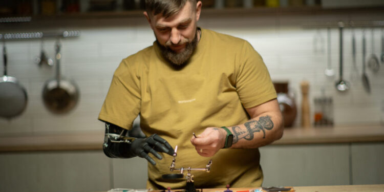 Український виробник біонічних протезів Esper Bionics залучив $5 млн – Экономика