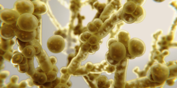 Кандидоз: что это и как проявляется