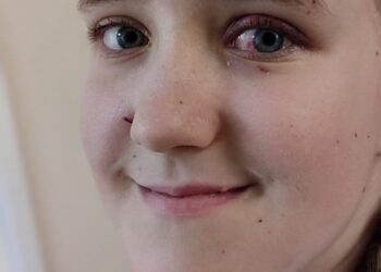 З’явилися фото дівчинки з Рівненщини, яку дістали з-під завалів Охматдиту