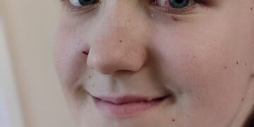 З’явилися фото дівчинки з Рівненщини, яку дістали з-під завалів Охматдиту