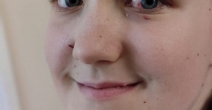 З’явилися фото дівчинки з Рівненщини, яку дістали з-під завалів Охматдиту