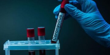 У Черкасах від ковіду помер чоловік