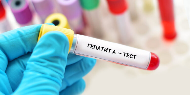 У Солотвинській громаді запровадять дистанційне навчання для учнів через поширення гепатиту A