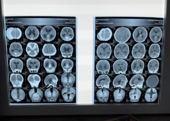 Рівненські лікарі подарували шанс на здорове життя новонародженому з рідкісною патологією