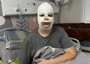 У Львові ушпиталили трьох дітей, які зробили вибухівку за інструкцією в TikTok