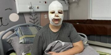 У Львові ушпиталили трьох дітей, які зробили вибухівку за інструкцією в TikTok
