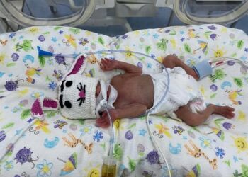 У Черкасах виходили новонароджене немовля з вагою 650 грамів — Новости Черкасс