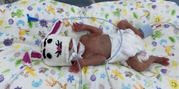 У Черкасах виходили новонароджене немовля з вагою 650 грамів — Новости Черкасс