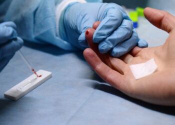 Спалах гепатиту А в столиці: на Відрадному стартує безкоштовне обстеження