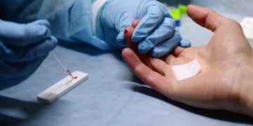 Спалах гепатиту А в столиці: на Відрадному стартує безкоштовне обстеження