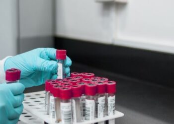 У Києві зареєстрували 83 випадки захворювання на гепатит А