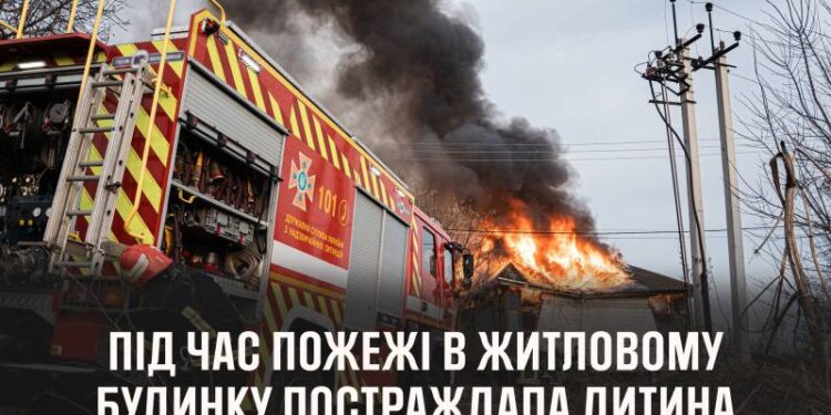 На Шепетівщині під час пожежі постраждала дитина —Хмельнитчина