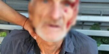У столиці судитимуть 60-річного нападника, який погрожував ножем і грабував жінок