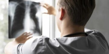 На Канівщині фіксують нові випадки туберкульозу: яка ситуація у громаді