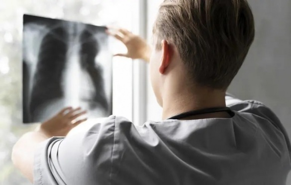 На Канівщині фіксують нові випадки туберкульозу: яка ситуація у громаді