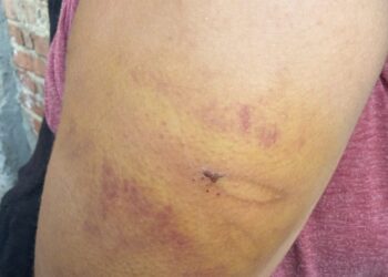 Офіс Омбудсмана України відреагував на постійні побиття доньки батьками-християнами