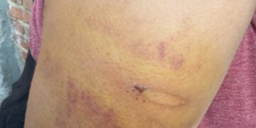 Офіс Омбудсмана України відреагував на постійні побиття доньки батьками-християнами