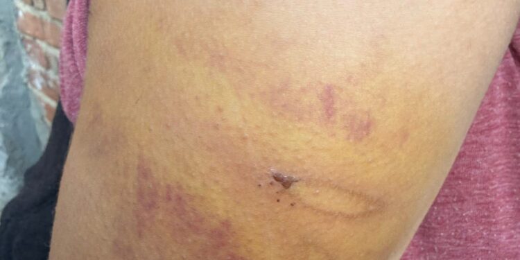 Офіс Омбудсмана України відреагував на постійні побиття доньки батьками-християнами