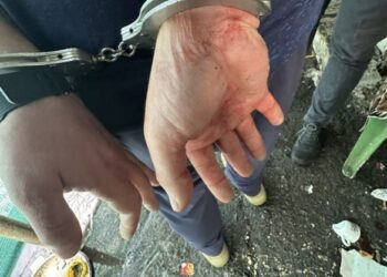 У Черкасах конфлікт за столом завершився різаниною: до лікарні госпіталізували жінку