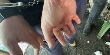 У Черкасах конфлікт за столом завершився різаниною: до лікарні госпіталізували жінку