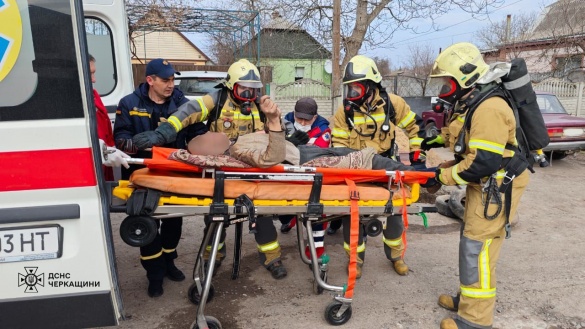 У Золотоноші під час пожежі постраждав чоловік
