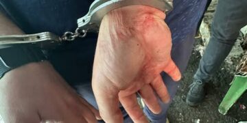 Ударив ножем у спину: у Черкасах чоловік поранив 27-річну жінку — Новости Черкасс