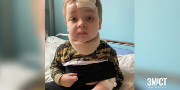 Збір для постраждалого хлопчика оголосили у Полтаві – ПОЛТАВА СЬОГОДНІ