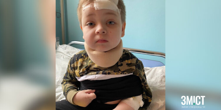Збір для постраждалого хлопчика оголосили у Полтаві – ПОЛТАВА СЬОГОДНІ