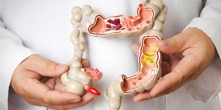 Як підготуватись до колоноскопії: прості поради без зайвого стресу