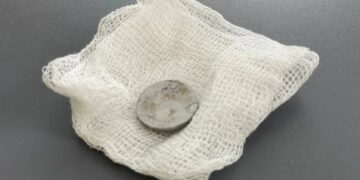 Три місяці з батарейкою у стравоході: у Львові врятували дворічну дівчинку